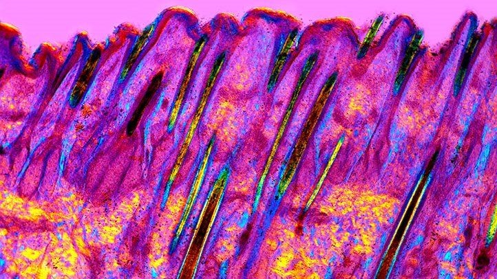 ingrijire anti-imbatranire a pielii